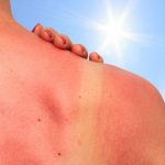 Skin and Sun Health